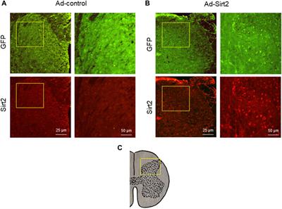 Sirt2 in the Spinal Cord Regulates Chronic Neuropathic Pain Through Nrf2-Mediated Oxidative Stress Pathway in Rats